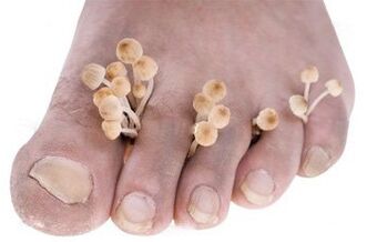 Fungus on the feet
