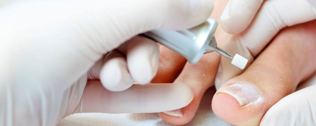 Cut the upper layer of the nail