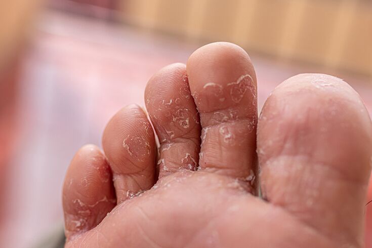 Fingers